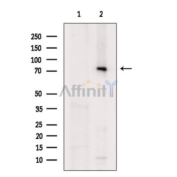 Phospho-SRPK2 (Thr492) Antibody - Western blot analysis of extracts from Mouse brain, using Phospho-SRPK2 (Thr492) Antibody.