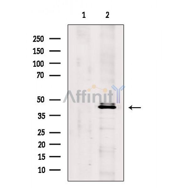 Phospho-GAP43 (Ser41) Antibody - Western blot analysis of extracts from COS-7 cells(uv treatment), using Phospho-GAP43 (Ser41) Antibody.