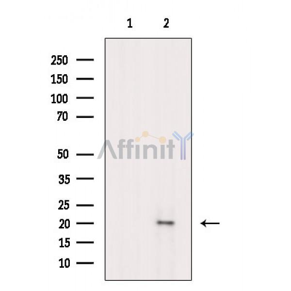 Phospho-CRYAB (Ser59) Antibody - Western blot analysis of extracts from Rat heart, using Phospho-CRYAB (Ser59) Antibody.