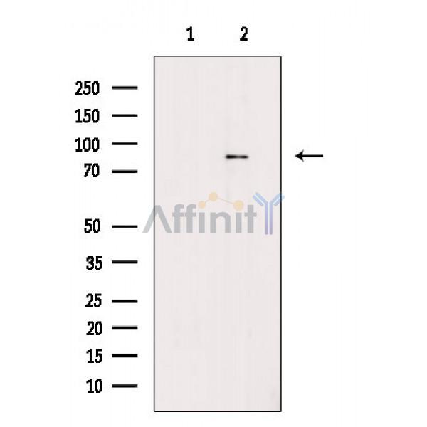 Phospho-LETM1 (Thr192) Antibody - Western blot analysis of extracts from P19 cells(heat shock treatment), using Phospho-LETM1 (Thr192) Antibody.