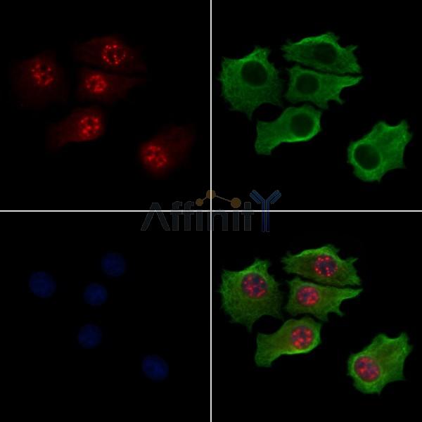Phospho-Bub1 (Thr461) Antibody - AF3768 staining HepG2 cells(serum starvation treatment) by IF/ICC.