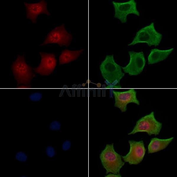 Phospho-FOXO3A (Ser318/Ser321) Antibody - AF3772 staining HepG2 cells(serum starvation treatment) by IF/ICC.