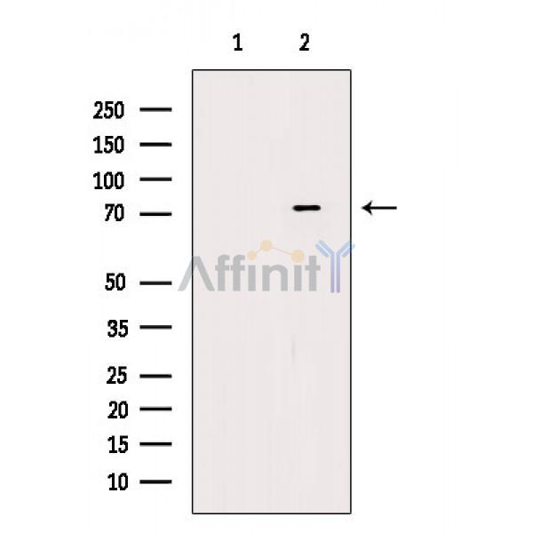 Phospho-DDX3 (Ser102) Antibody - Western blot analysis of extracts from A549 cells, using Phospho-DDX3 (Ser102) Antibody.