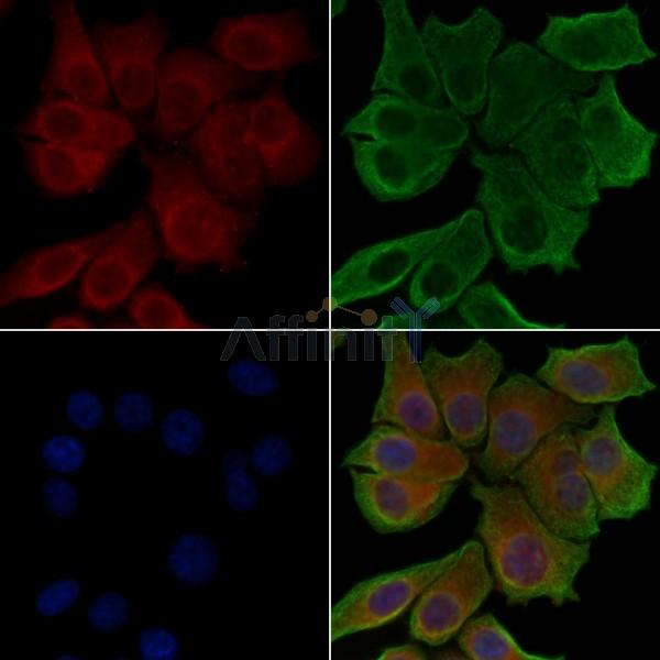 Phospho-MLC2 (Ser19) Antibody - AF3829 staining HepG2 cells(serum starvation treatment) by IF/ICC.