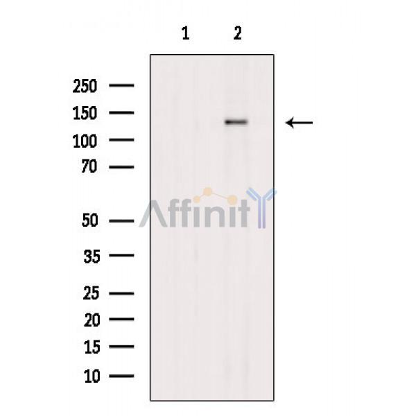 Phospho-ZEB2 (Ser784) Antibody - Western blot analysis of extracts from Rat liver, using Phospho-ZEB2 (Ser784) Antibody.