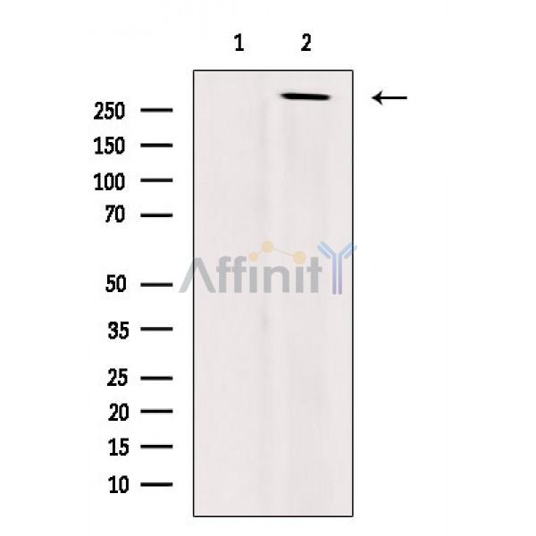 Phospho-Rpb1 CTD (Thr4) Antibody - Western blot analysis of extracts from Mouse brain, using Phospho-Rpb1 CTD (Thr4) Antibody.