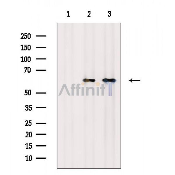Phospho-MKK7 (Thr275) Antibody - Western blot analysis of extracts from various samples, using Phospho-MKK7 (Thr275) Antibody.