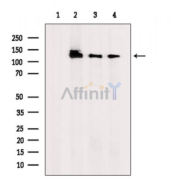 Phospho-MCM2 (Ser108) Antibody - Western blot analysis of extracts from various samples, using Phospho-MCM2 (Ser108) Antibody.