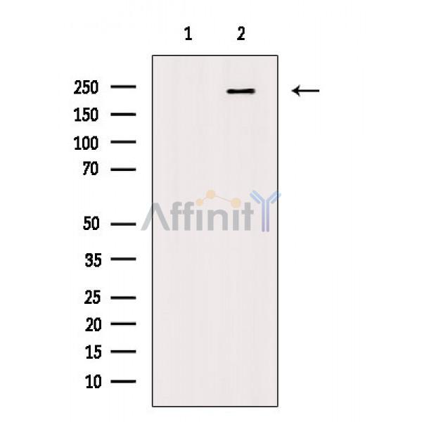 Phospho-LRRK2 (Ser910) Antibody - Western blot analysis of extracts from Hela cells(heat shock treatment), using Phospho-LRRK2 (Ser910) Antibody.