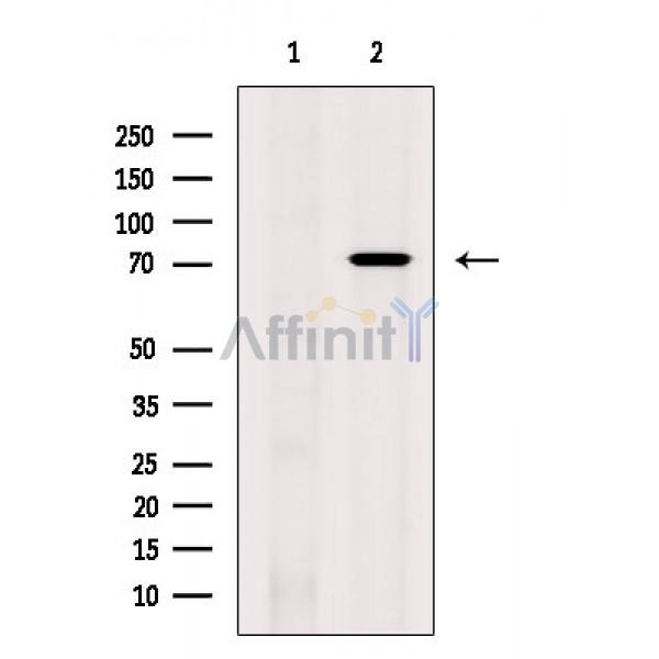 LIMK1 Antibody - Western blot analysis of extracts from COS-7 cells(uv treatment), using LIMK1 Antibody.
