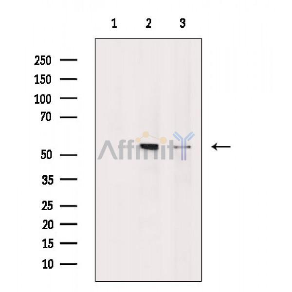 MLKL Antibody - Western blot analysis of extracts from various samples, using MLKL Antibody.