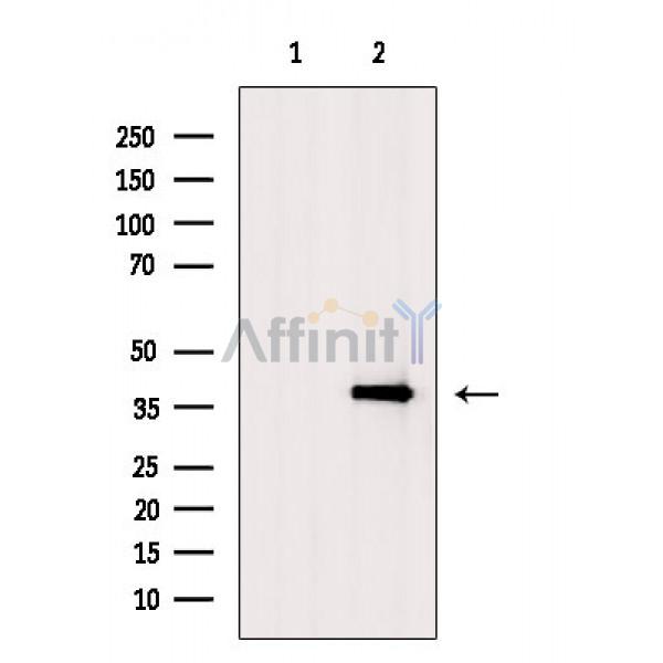 SIRT6 Antibody - Western blot analysis of extracts from 293 cells(heat shock treatment), using SIRT6 Antibody.