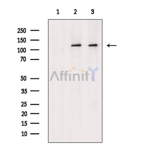 Bub1 Antibody - Western blot analysis of extracts from various samples, using Bub1 Antibody.
