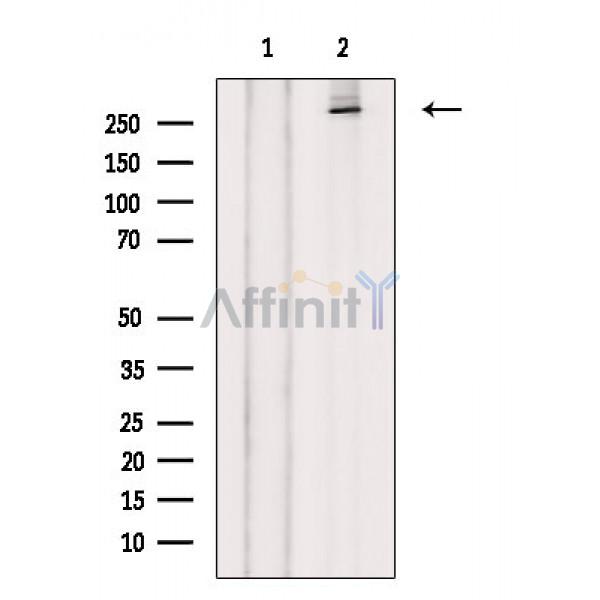 LRRK2 Antibody - Western blot analysis of extracts from 293 cells(UV treatment), using LRRK2 Antibody.