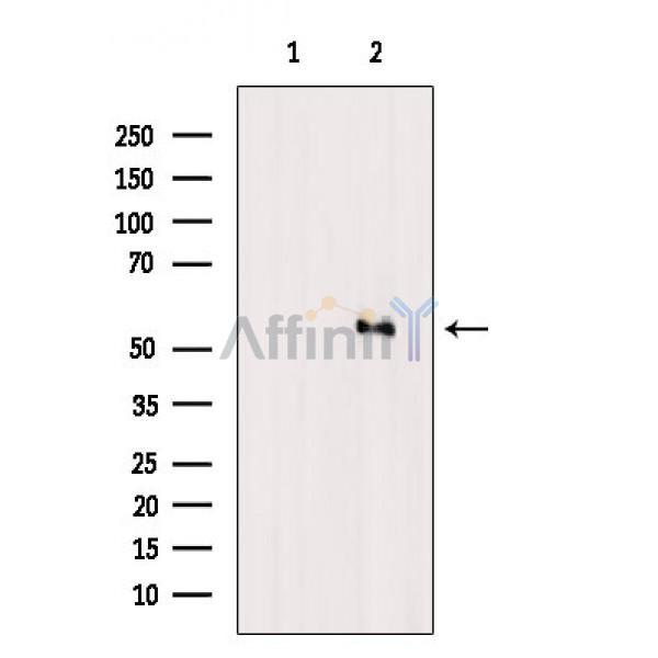 MLKL Antibody - Western blot analysis of extracts from heat-shock treated 290, using MLKL Antibody.
