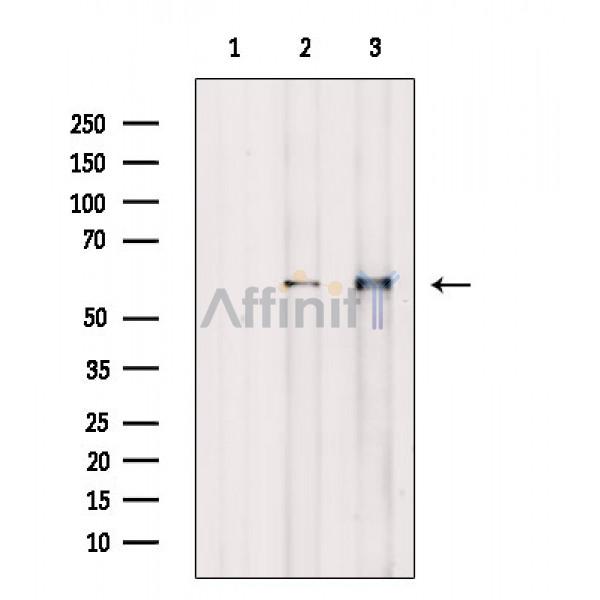 Phospho-BLK (Tyr389) Antibody - Western blot analysis of extracts from various samples, using Phospho-BLK (Tyr389) Antibody.
