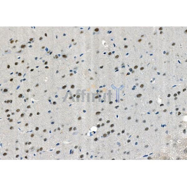USP36 Antibody - AF9223 at 1/100 staining Rat brain tissue by IHC-P.