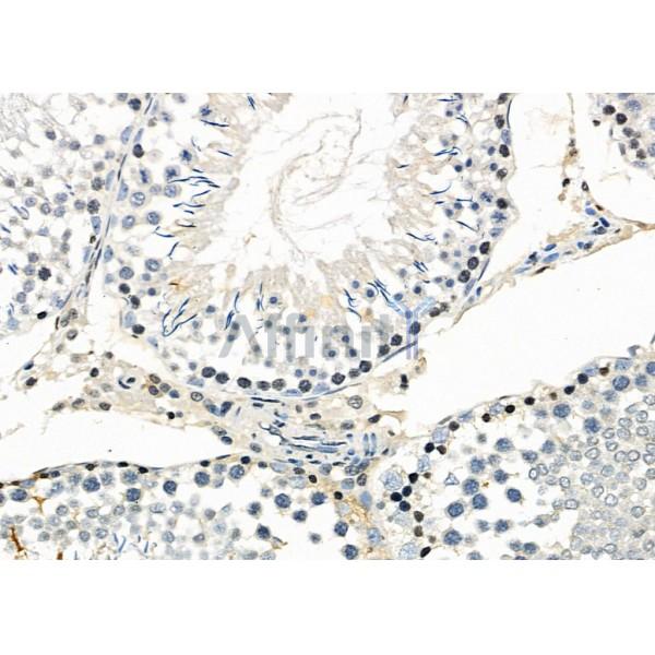 MAGEA12 Antibody - DF10034 at 1/100 staining Rat testis tissue by IHC-P.