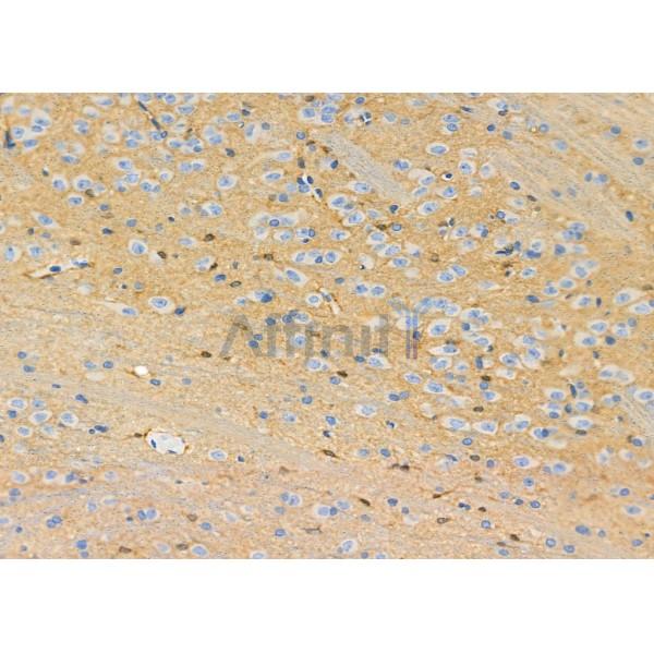 MAGE2 Antibody - DF10041 at 1/100 staining Rat brain tissue by IHC-P.