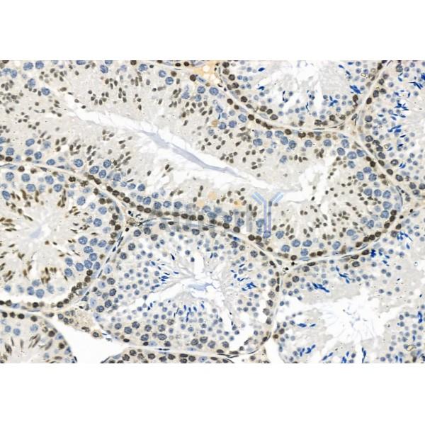 PCTK2 Antibody - DF10139 at 1/100 staining Mouse testis tissue by IHC-P.