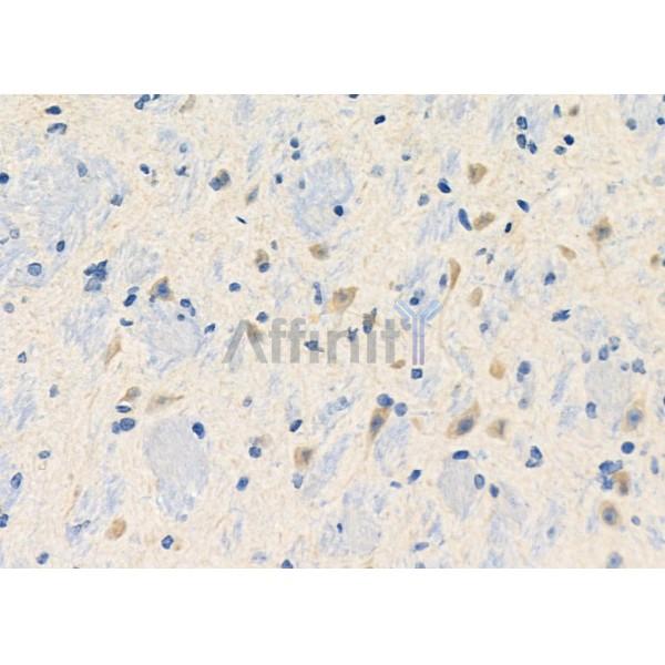BAI3 Antibody - DF10201 at 1/100 staining Mouse brain tissue by IHC-P.