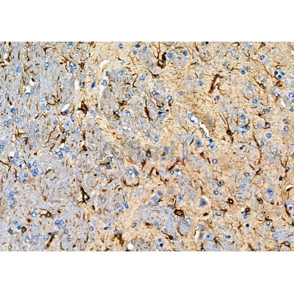 OR1A2 Antibody - DF10238 at 1/100 staining Mouse brain tissue by IHC-P.