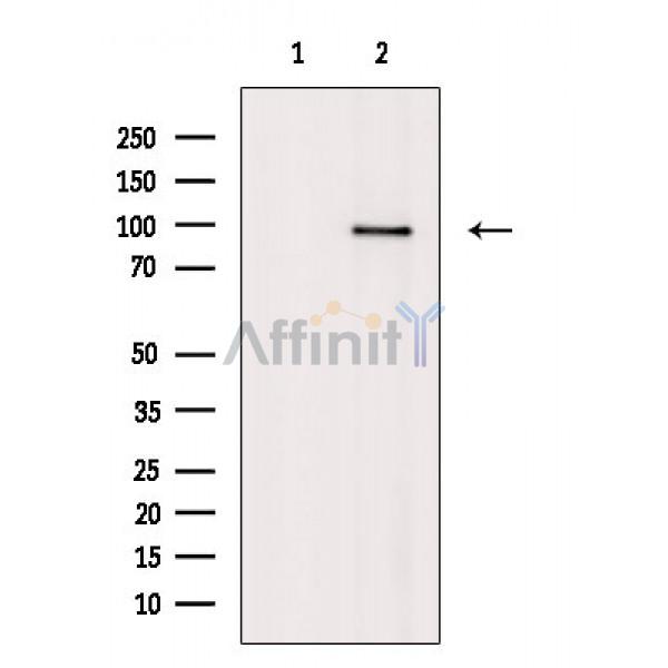 DAG1 Antibody - Western blot analysis of extracts from heat-shock treated HepG2 cells, using DAG1 Antibody.