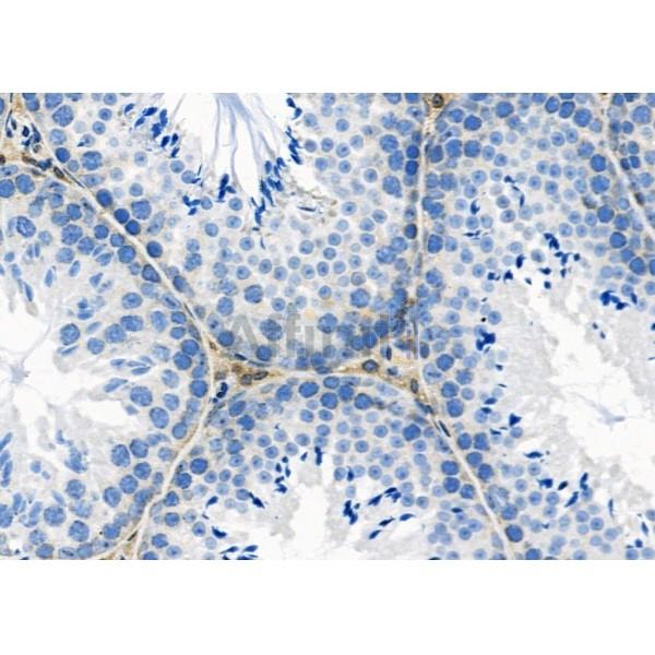 NBPF4 Antibody - DF2215 at 1/100 staining Mouse testis tissue by IHC-P.