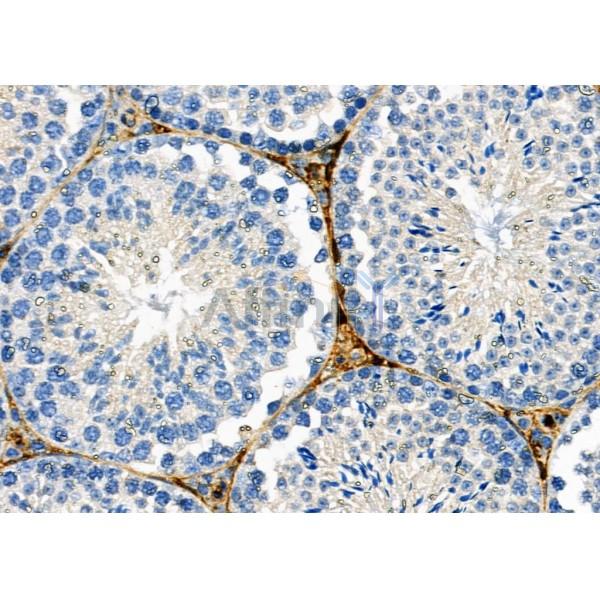 KCNE2 Antibody - DF2222 at 1/100 staining Mouse liver tissue by IHC-P.