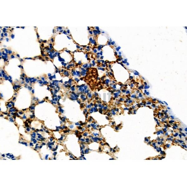 KCNE2 Antibody - DF2222 at 1/100 staining Mouse stomach tissue by IHC-P.