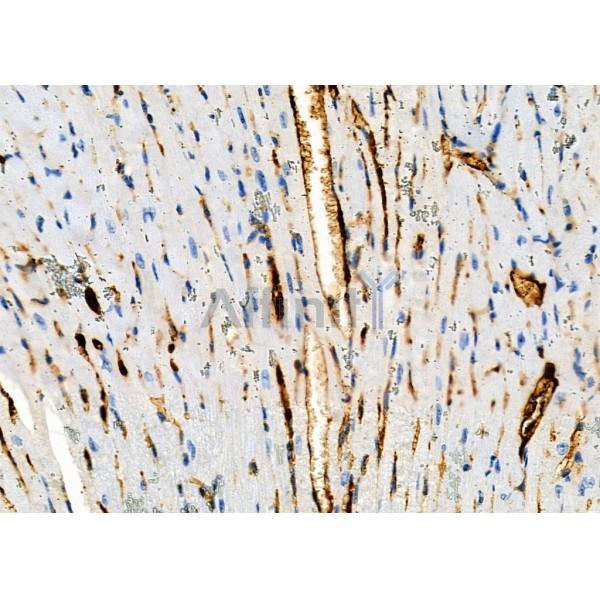 KCNE2 Antibody - DF2222 at 1/100 staining Mouse muscle tissue by IHC-P.