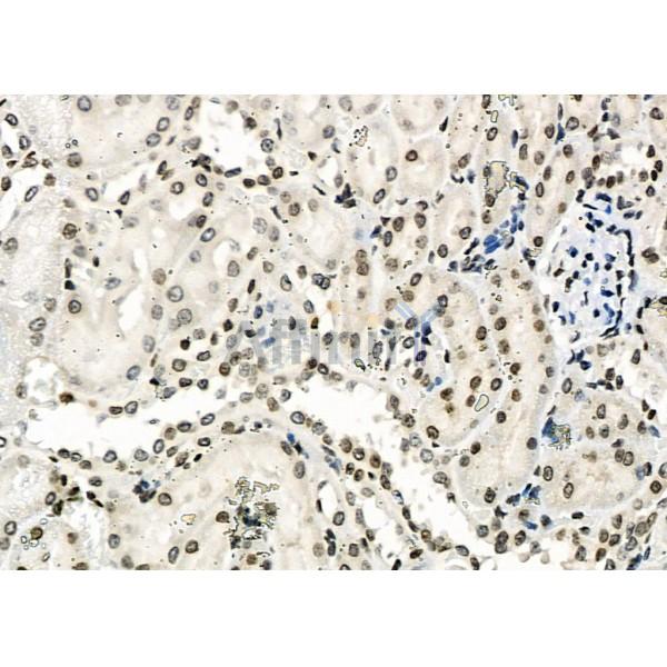 APR3 Antibody - DF2273 at 1/100 staining Rat kidney tissue by IHC-P.