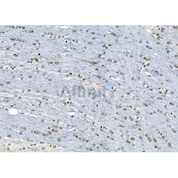 APR3 Antibody - DF2273 at 1/100 staining Rat brain tissue by IHC-P.