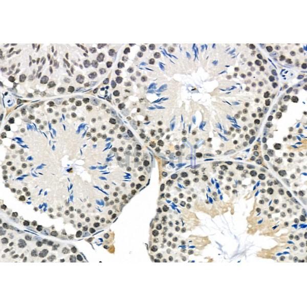 Cylicin 1 Antibody - DF2330 at 1/100 staining Mouse testis tissue by IHC-P.