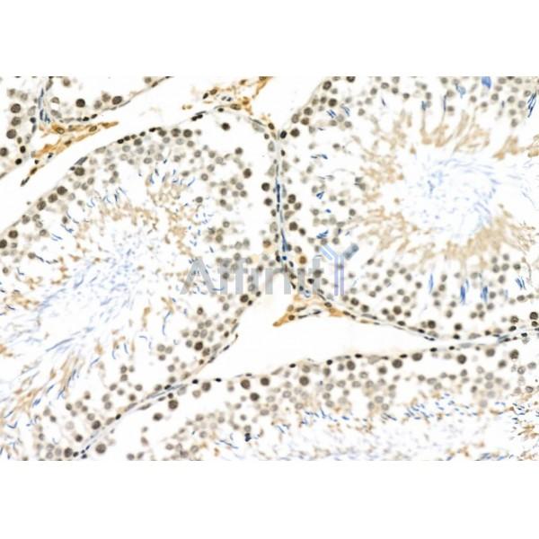 Cylicin 1 Antibody - DF2330 at 1/100 staining Rat testis tissue by IHC-P.
