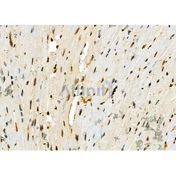 NUFIP2 Antibody - DF2420 at 1/100 staining Mouse heart tissue by IHC-P.
