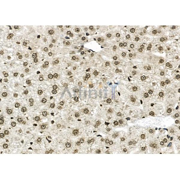 NUFIP2 Antibody - DF2420 at 1/100 staining Mouse liver tissue by IHC-P.