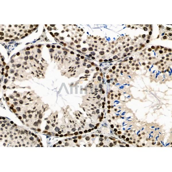 NUFIP2 Antibody - DF2420 at 1/100 staining Mouse testis tissue by IHC-P.