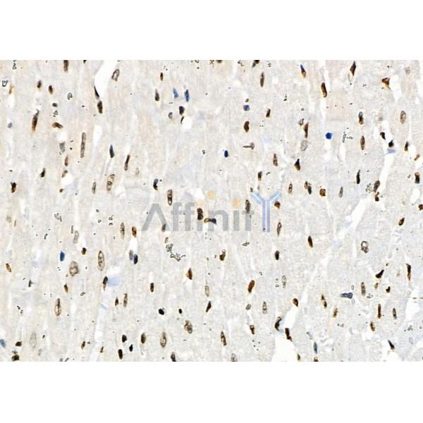 NUFIP2 Antibody - DF2420 at 1/100 staining Rat heart tissue by IHC-P.