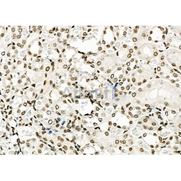 NUFIP2 Antibody - DF2420 at 1/100 staining Rat kidney tissue by IHC-P.