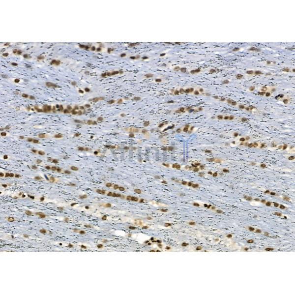 NUFIP2 Antibody - DF2420 at 1/100 staining Rat brain tissue by IHC-P.