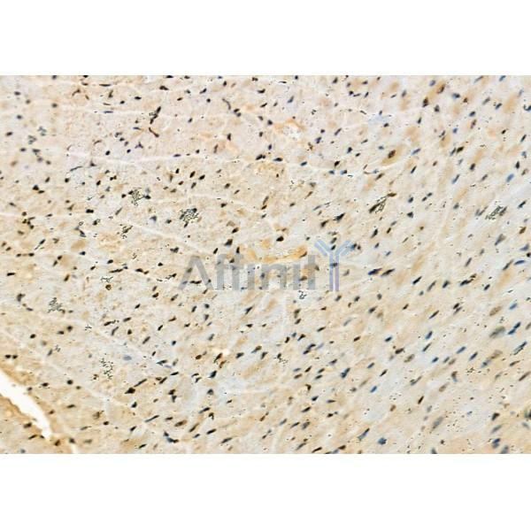 MIXL1 Antibody - DF2467 at 1/100 staining Mouse heart tissue by IHC-P.