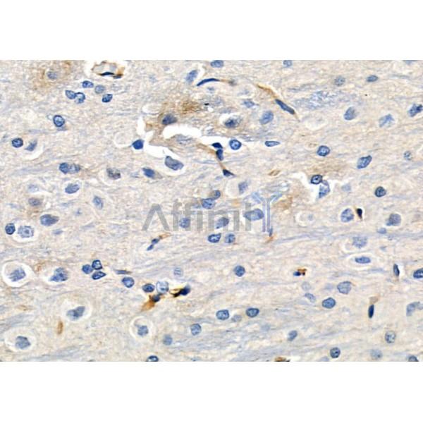 GRIP1 Antibody - DF2500 at 1/100 staining Rat brain tissue by IHC-P.