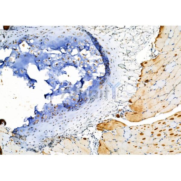 KRT31/33A/33B Antibody - DF2553 at 1/100 staining Rat skin tissue by IHC-P.