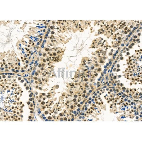 TSSK3 Antibody - DF2686 at 1/100 staining Mouse testis tissue by IHC-P.
