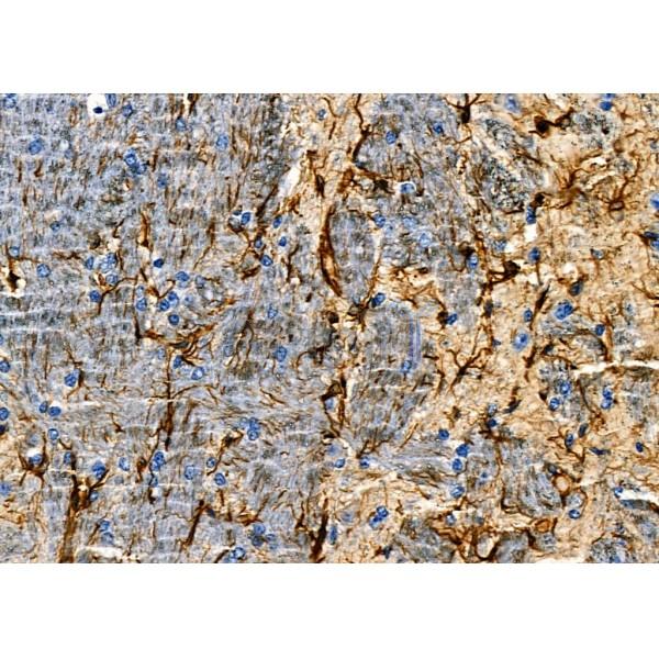 OR51A1P Antibody - DF2715 at 1/100 staining Mouse brain tissue by IHC-P.