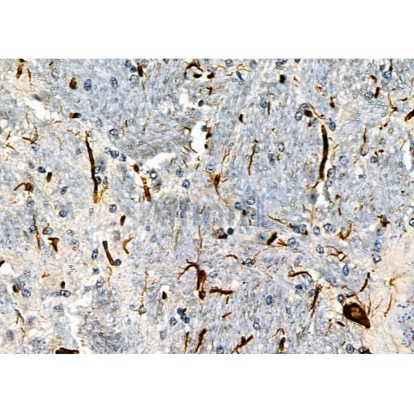 OR52Z1P Antibody - DF2716 at 1/100 staining Mouse brain tissue by IHC-P.