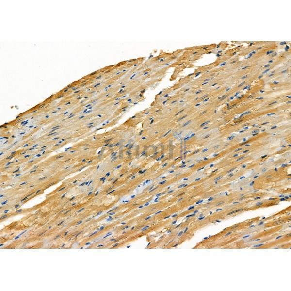 M-CK Antibody - DF3072 at 1/100 staining Rat heart tissue by IHC-P.