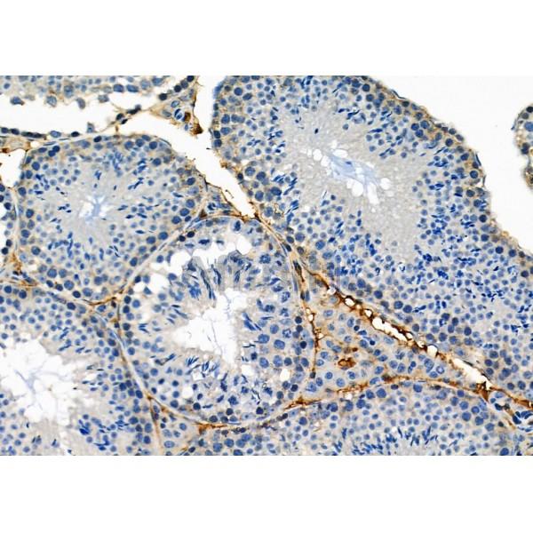 BNIP2 Antibody - DF3827 at 1/100 staining Mouse testis tissue by IHC-P.