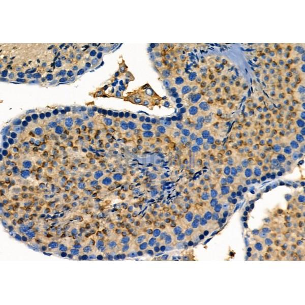 RABEP2 Antibody - DF4368 at 1/100 staining Mouse testis tissue by IHC-P.